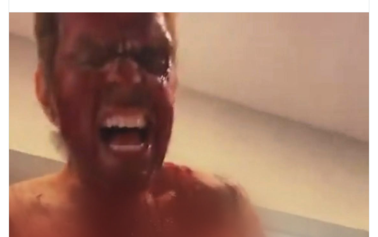 Serious: Gossip Blogger Perez Hilton Covered in Blood, Cuts Himself on Live TikTok, Causing So Much Concern Miami Dade Police Involved (Disturbing Video)